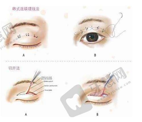 4. 动态美感塑造,兼顾睁眼与闭眼成效
