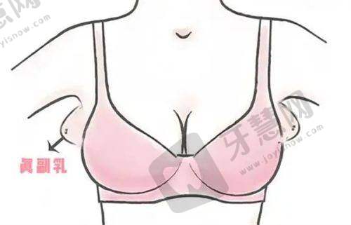 四、真人实例实测:三位求美者的蜕变故事