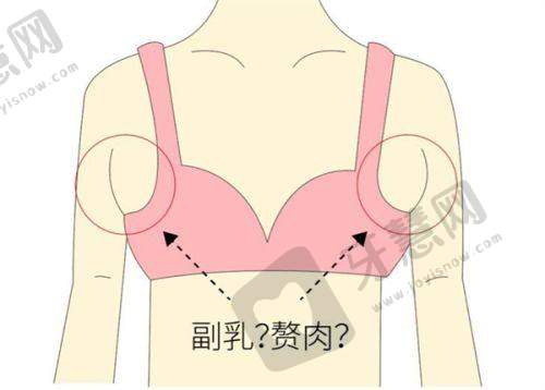 北京丰联丽格师丽丽医生双眼皮修复风格特色