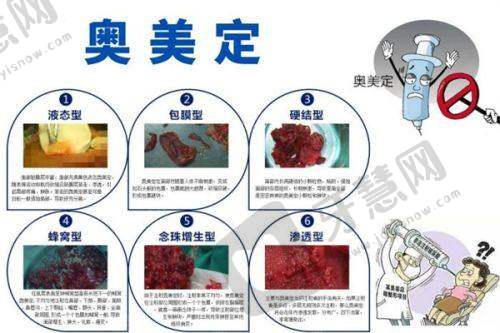 24小时男科在线问诊解答阴茎延长增粗价格