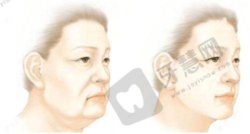 三、辽宁曙光医美车金昊巨乳缩小术优势亮点
