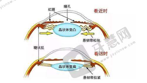 北京师丽丽眼修复怎么样？S - ACC技术+高成功率，众多案例见证神奇效果