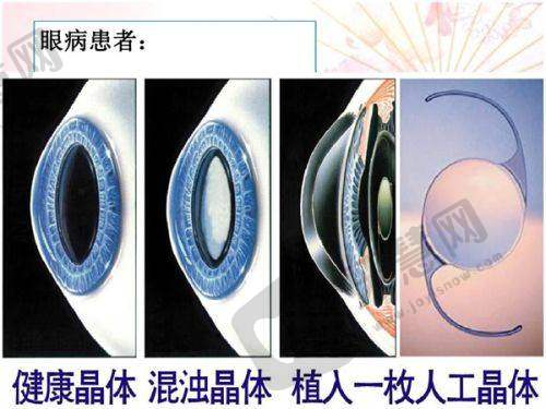 变性及去势手术的价格与费用构成