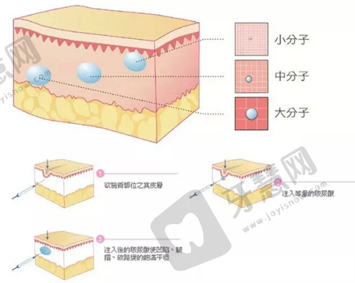 三、沈阳百嘉丽乳房下垂矫正术8大技术优势：为什么选择这里？