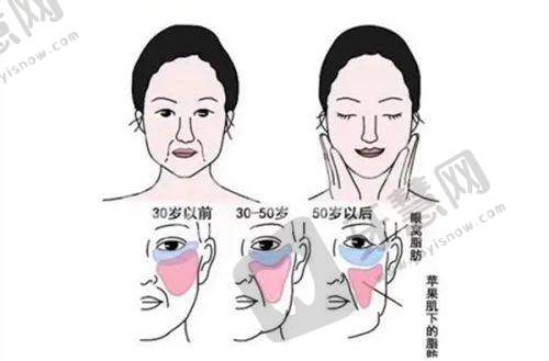 四、真人实例:23000元投资换来的自信与美丽
