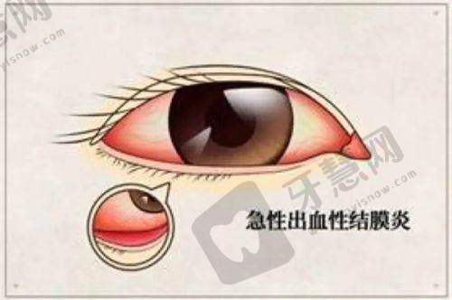 昆明红十字会眼科医院地址及乘车路线