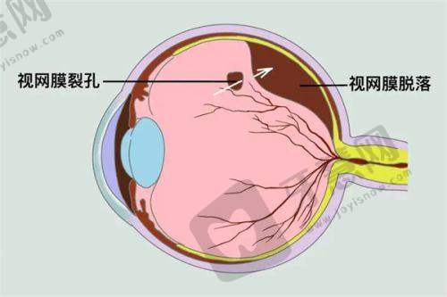 爱尔眼科的口碑评价
