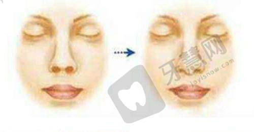 北京艺美医疗美容诊所怎么样，口碑评价如何？