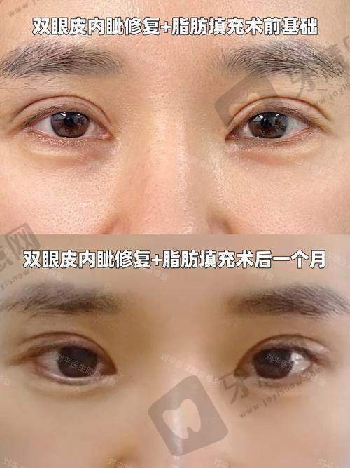 北京丰联丽格师丽丽眼修复的显著优势
