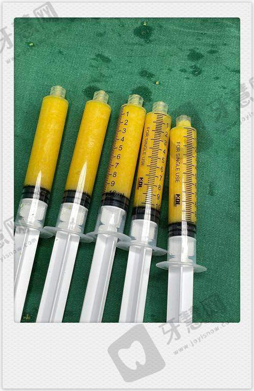 常双明医生的口碑评价及反馈内容：求美者高度评价