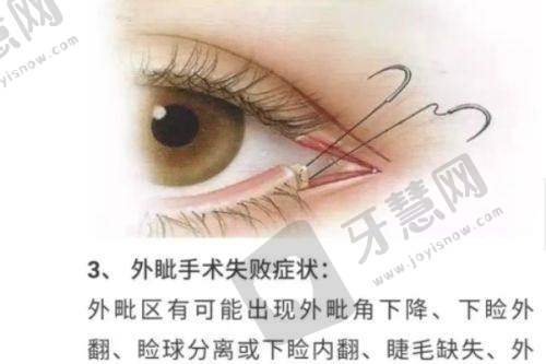 温州致臻颐和医疗美容诊所正规吗？