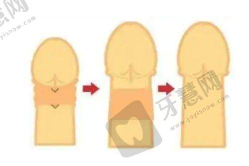 五、长沙整形医院哪家好服务优?甄美芯医疗美容
