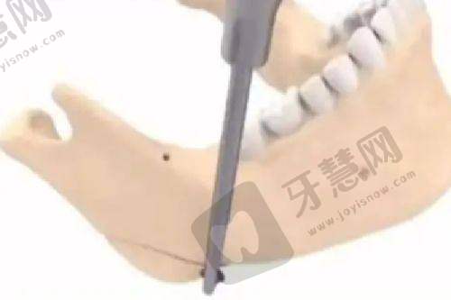 温州艺星医疗美容医院诊疗项目：