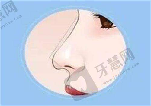 温州艺启美医疗美容门诊部正规吗？