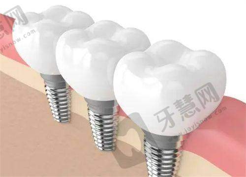 德韩口腔收费明细查询方式