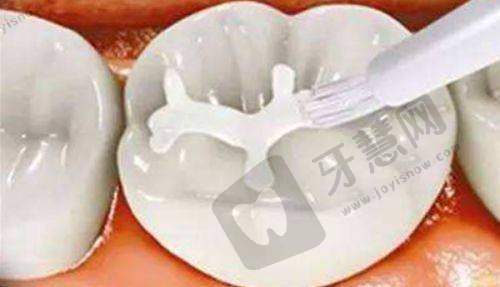 德韩口腔是不是属于正规医院？多地分院资质齐全，3D种牙技术获患者好评！