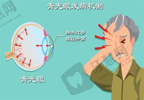 昆明红十字会眼科医院的口碑评价