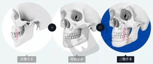 三:广州曙光疤痕修复中 心好吗?服务贴心周到