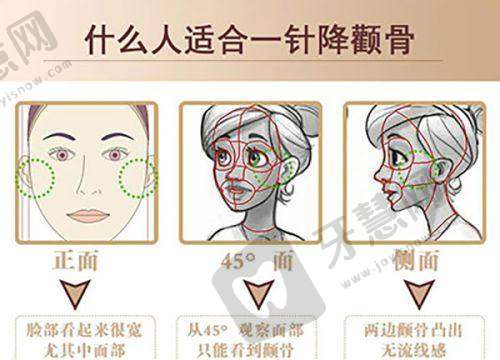 温州艺启美医疗美容门诊部预约挂号方式：