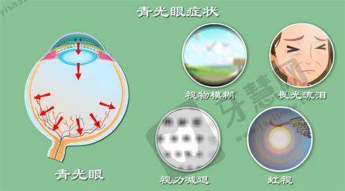 昆明红十字会眼科医院怎么预约挂号？多种方式及放号时间揭秘，特殊人群还有绿色通道！
