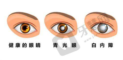 昆明红十字会眼科医院的价格表