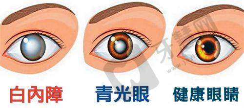 昆明红十字会眼科医院的优惠活动与注意事项提醒