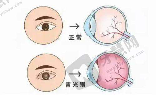 昆明普瑞眼科医院的预约挂号方式