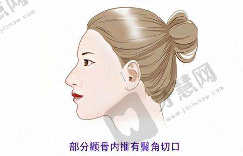 温州艺启美医疗美容门诊部诊疗项目：