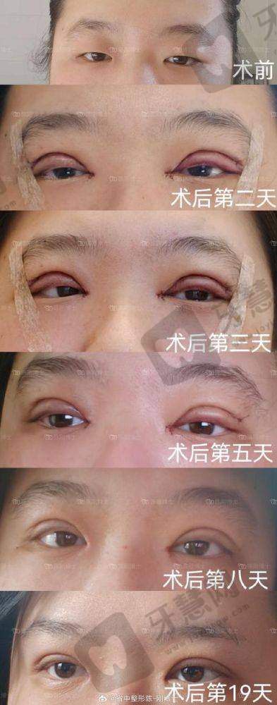 李宾炎医生擅长的注射整形项目
