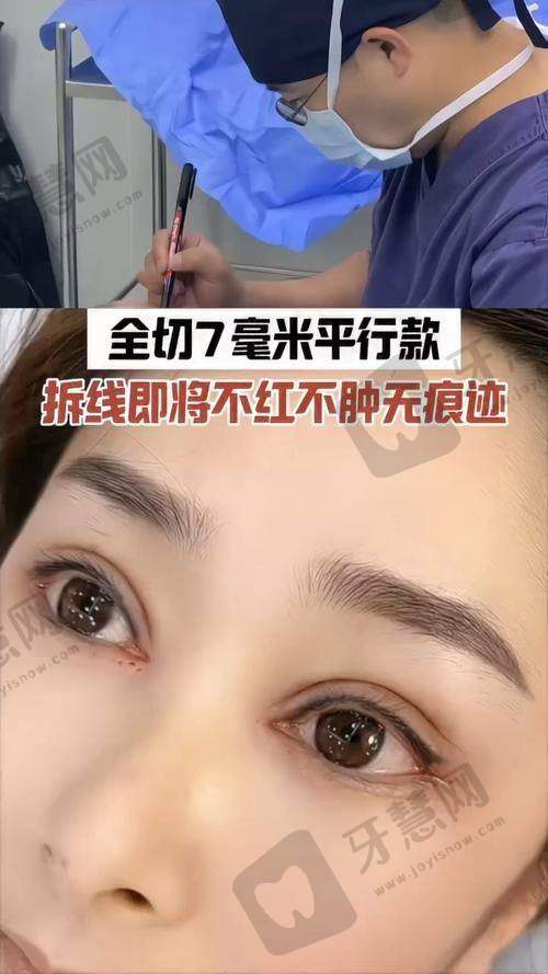 李宾炎医生顾客好评
