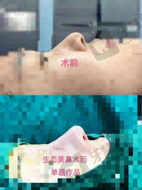 徐向民医生的擅长项目介绍