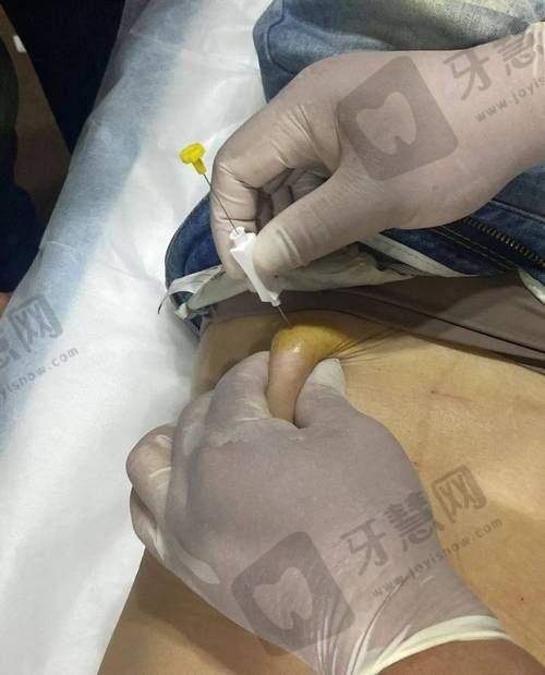 孟辉医生皮肤抗衰的技术优势