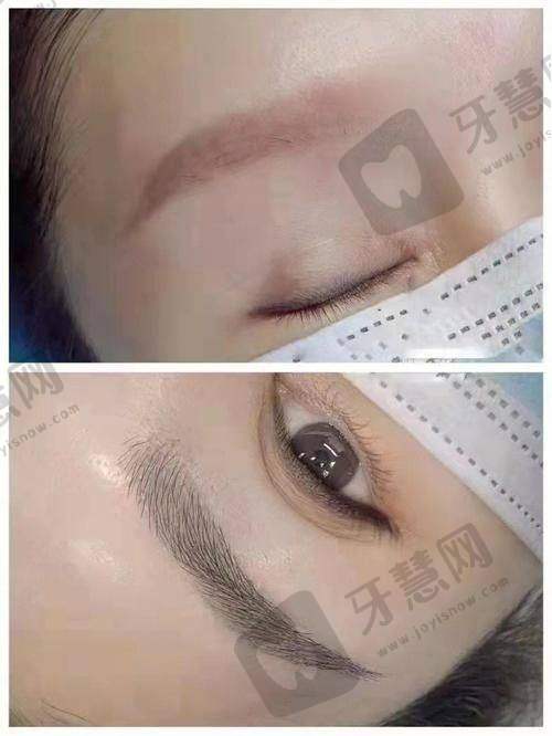 北京本爱医疗美容门诊部口碑好不好?附真实患者口碑评价