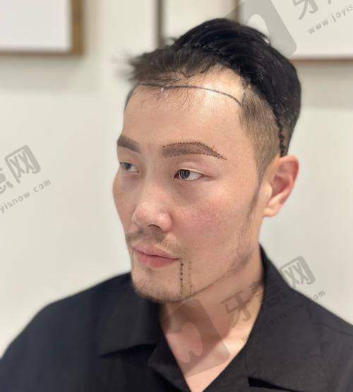 北京炫美整形美容门诊部怎么样，口碑评价如何