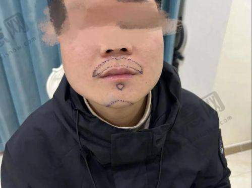北京美莱医疗美容门诊部医生简介