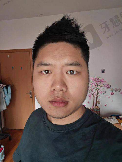 北京煤医西坝河医疗美容门诊部地址及乘车路线