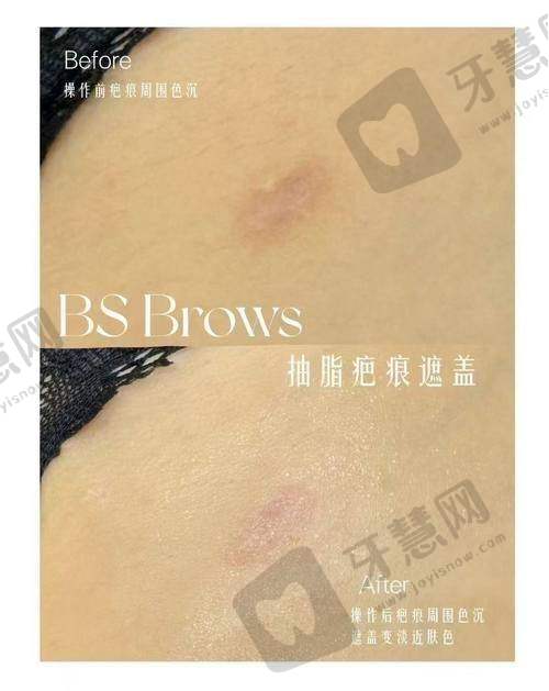 哈尔滨双燕医疗美容的技术特色是什么