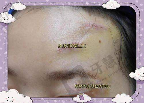 哈尔滨双燕医疗美容的特色项目有哪些