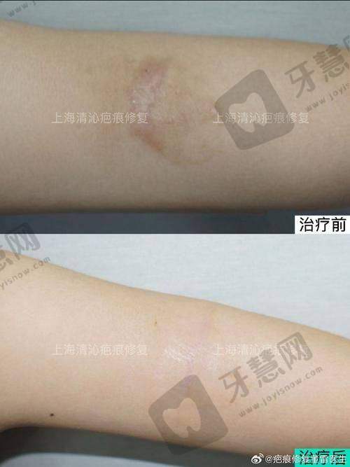 北京京城皮肤医院的特色优势总结