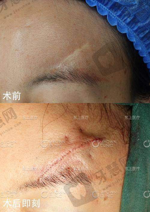 齐伯阳医生擅长的皮肤抗衰项目