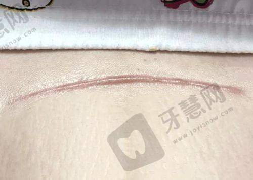 哈尔滨双燕医疗美容的价格贵吗