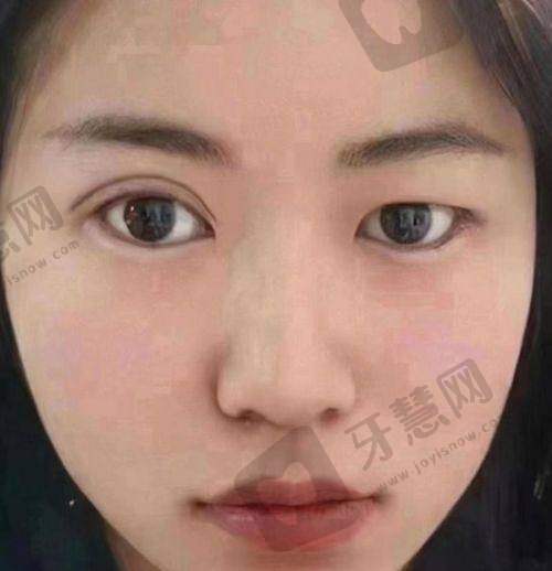 李宾炎医生注射整形技术优势