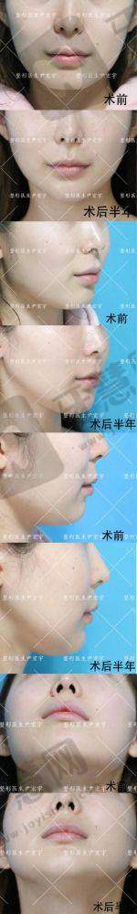 北京美莱医疗美容门诊部怎么样，口碑评价如何？