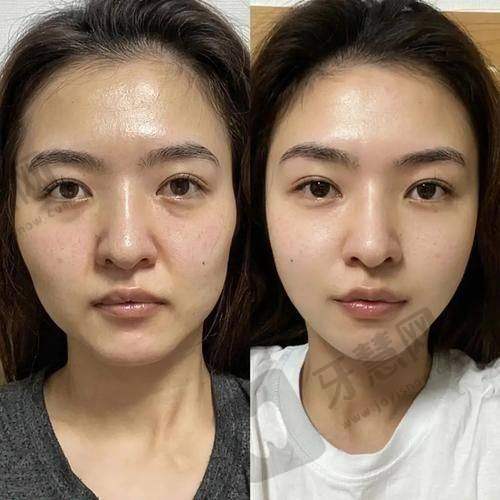 任琳医生擅长的女性私密维养与黄褐斑治疗项目