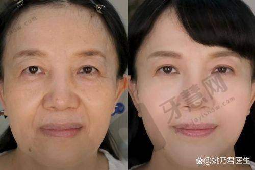 郭丽林医生独特的技术优势