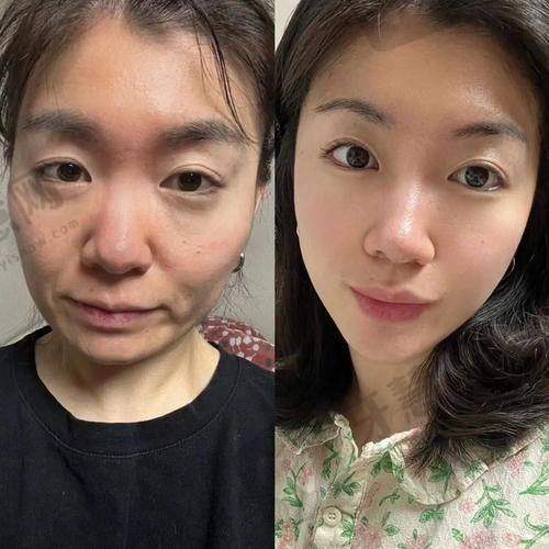 任琳医生在北京空美圣医的口碑评价及反馈内容