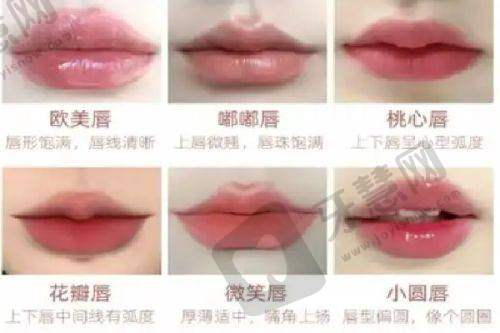 深圳艺星整形价格表查询之微整形价格