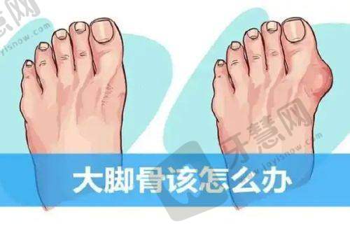 韩国大眼睛整形医院怎么样？高韩雄做眼整形技术强，眼修复评价高价格公道