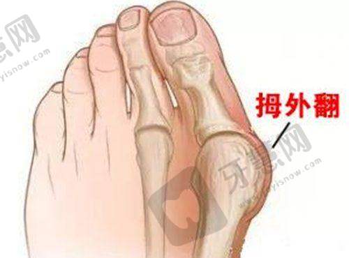 新大连爱德丽格做眼部整形收费表:与其他医院的价格对比