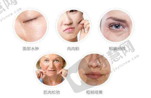 姐妹们都在问的重庆卢美均星眸眼双眼皮避坑之手术方案确定